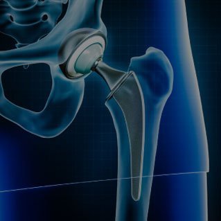 best hip doctor in kolkata